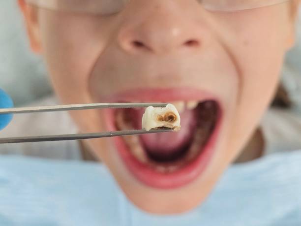 Best Pediatric Emergency Dentist in Roseau, MN