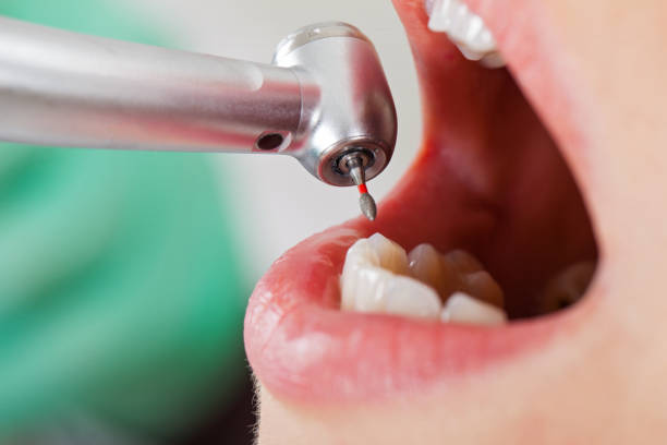 Best Emergency Broken Tooth Repair in Roseau, MN
